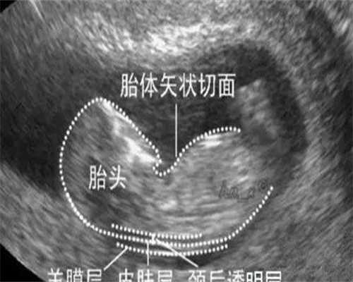 天津38岁拉拉试管全记录：成功率与费用真相