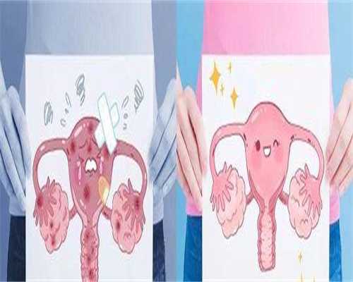 52岁天津试管成功率高吗？高龄备孕真实体感与花费分享