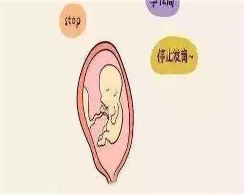 闭经不孕好治疗吗